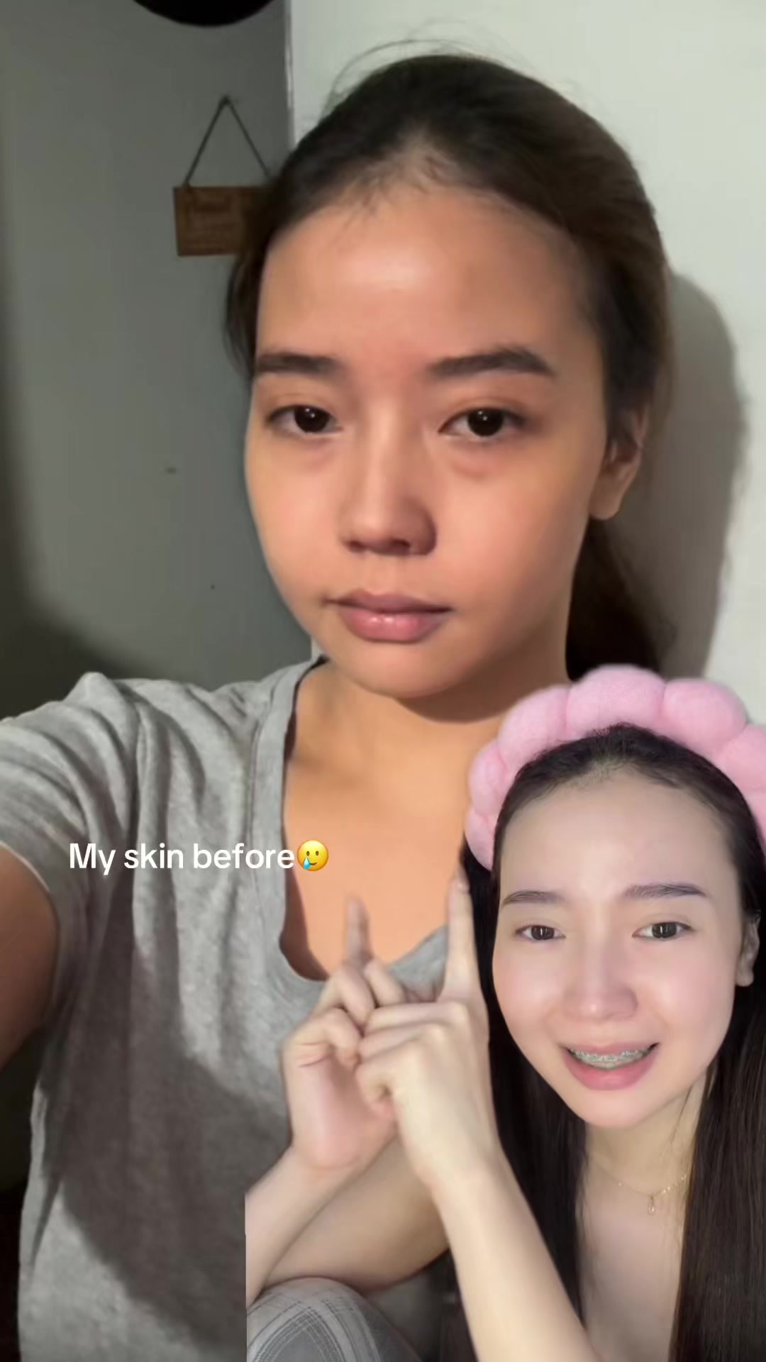 @Chaydump