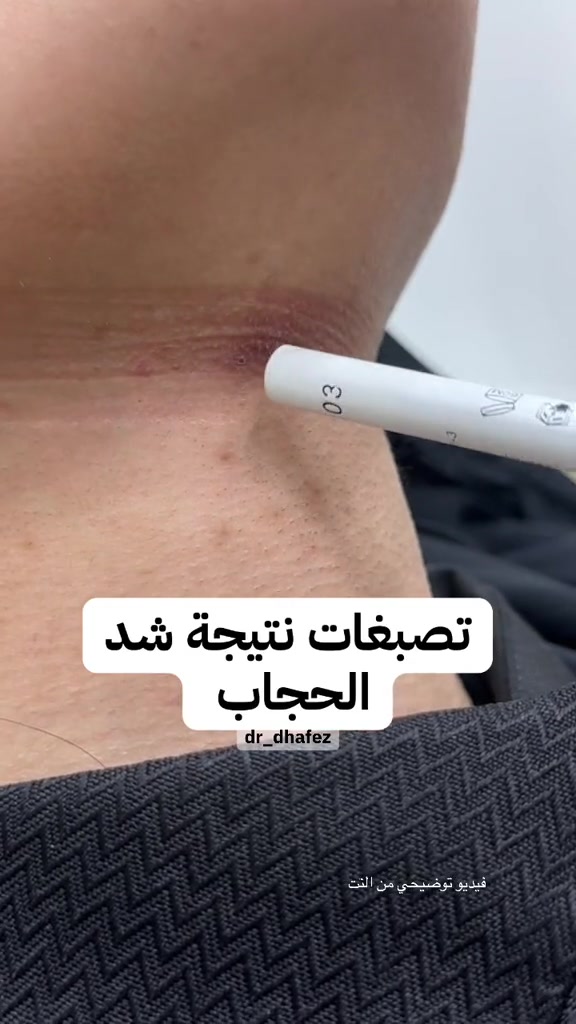 @د. ظافر آل حافظ
