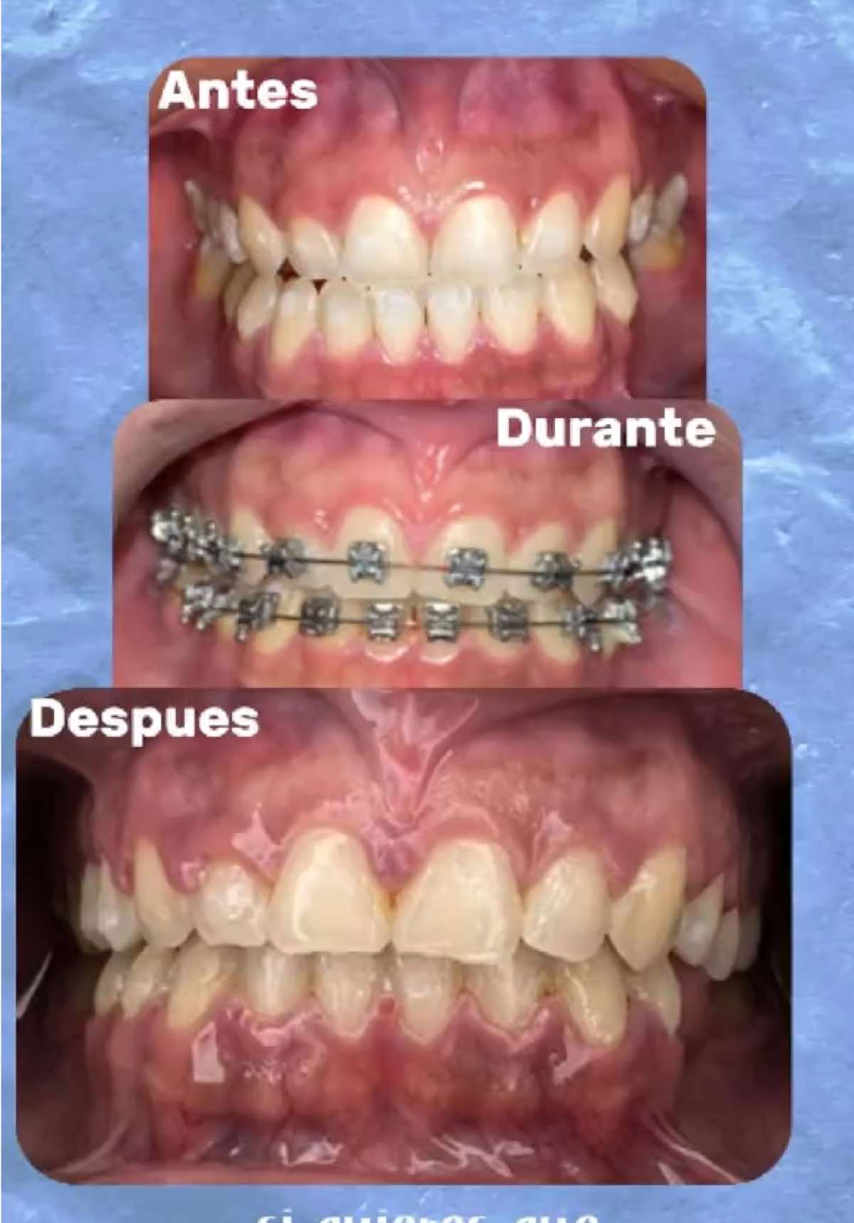 @pro.dental.od
