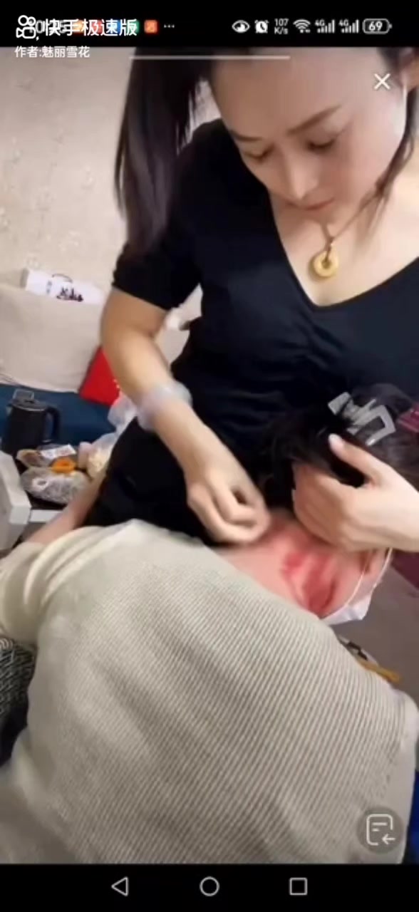 @thích cạo gió