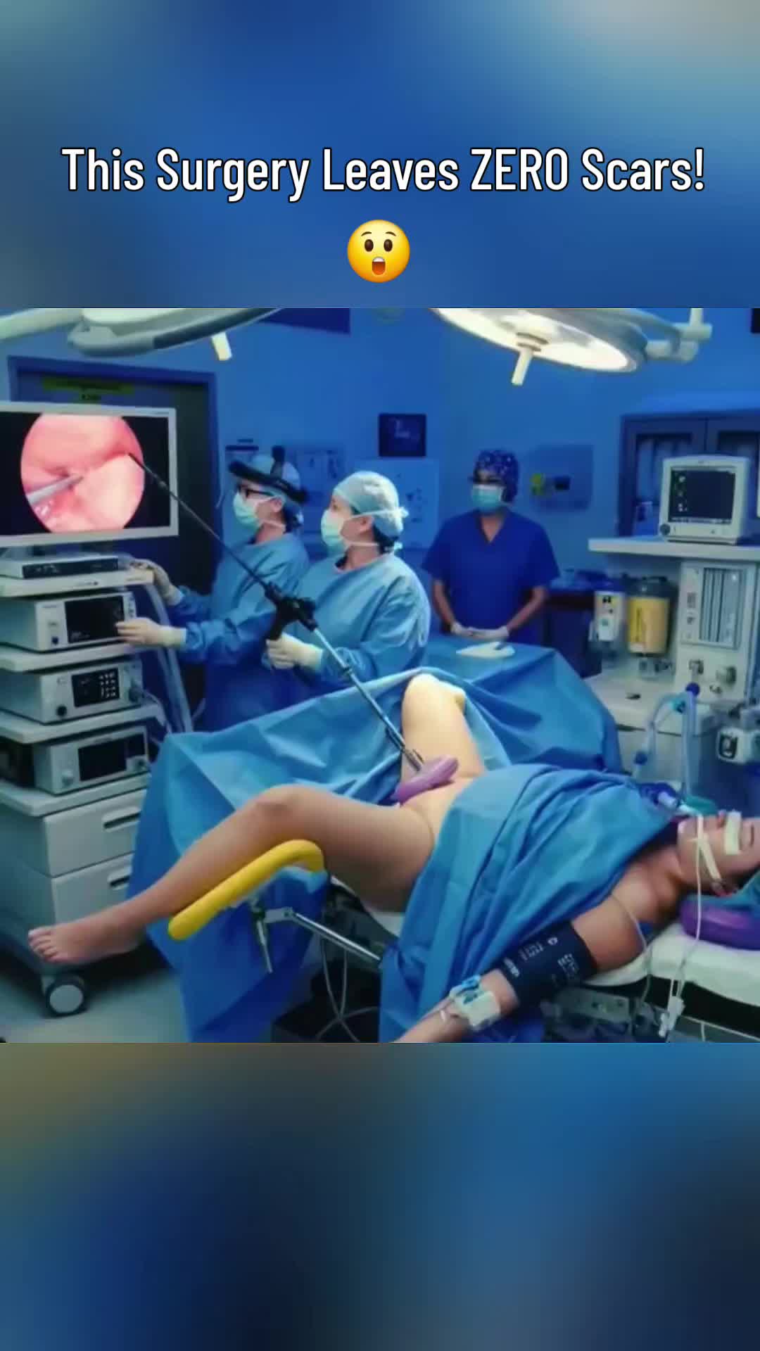 @Secret Body AI