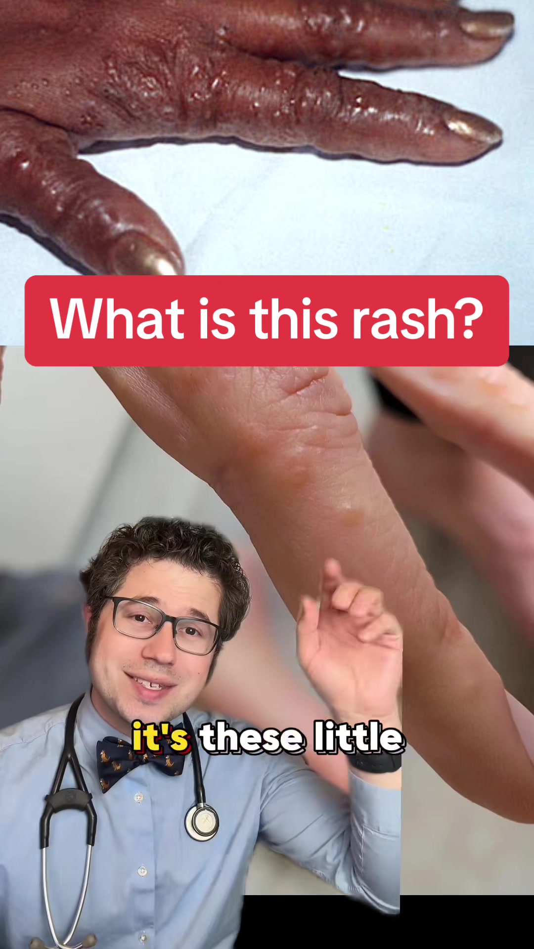 @Dr. Rubin, MD