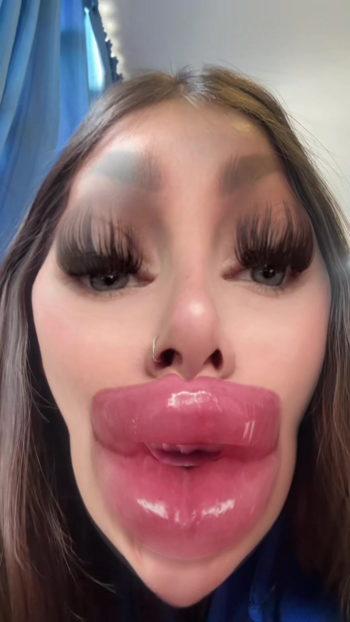 @4toenfasis