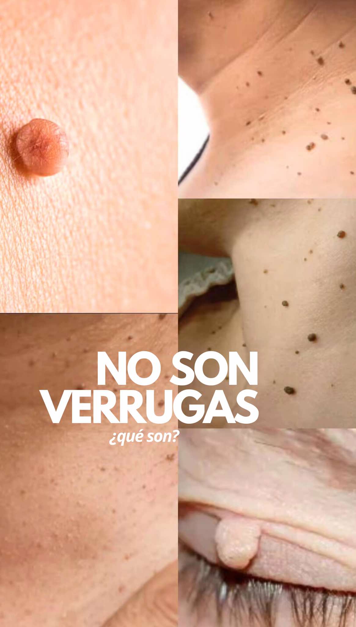 @Belén Estévez