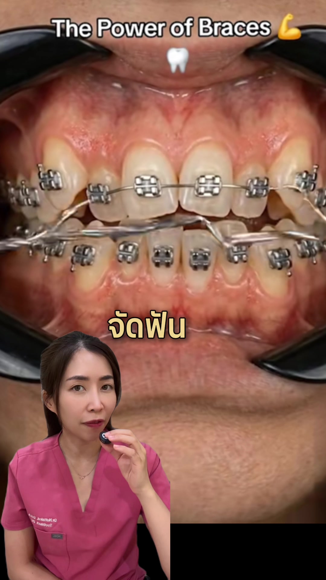 @ณัฐคุณ (Nuttakul Dent) 🦷