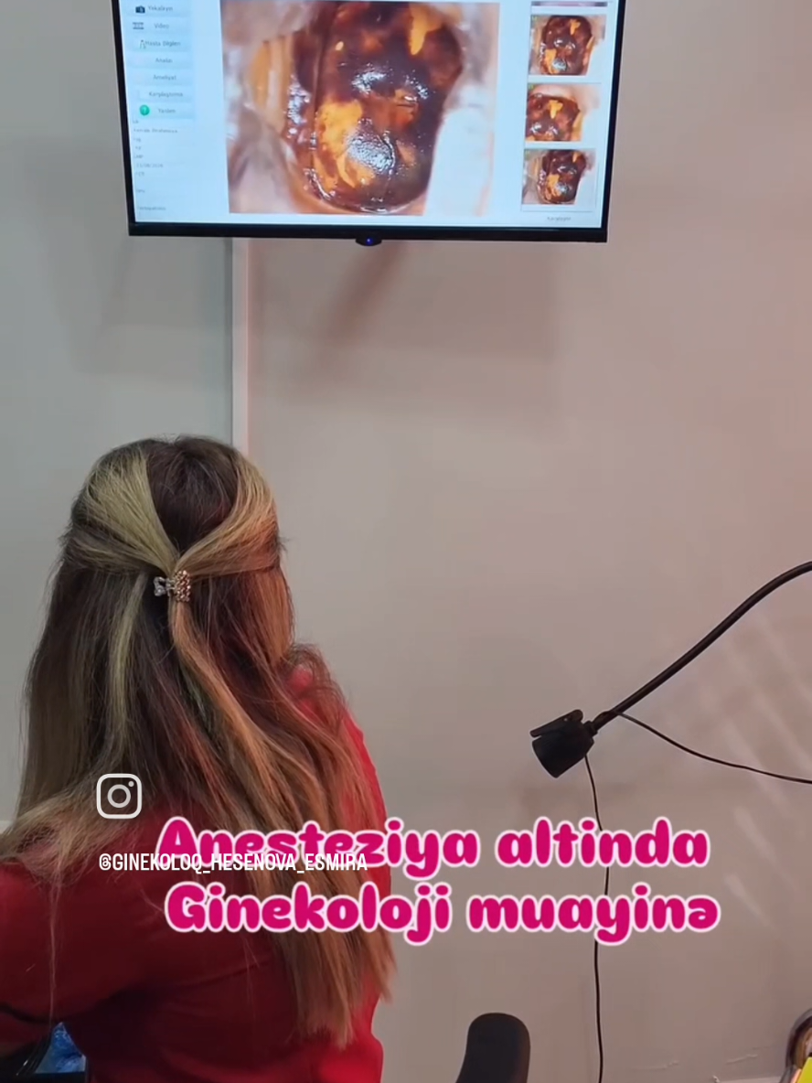 @Ginekoloq Esmira Hasanova