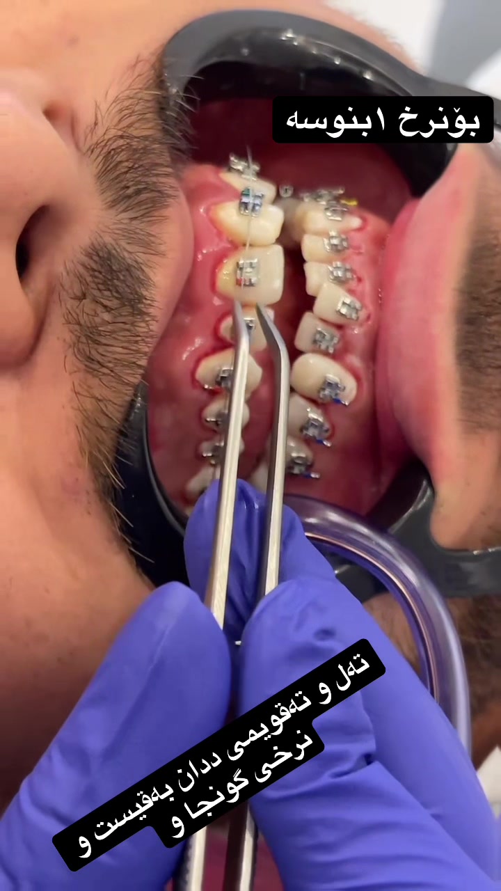 @🦷 دکتۆرە ئیمان کاکەمەم