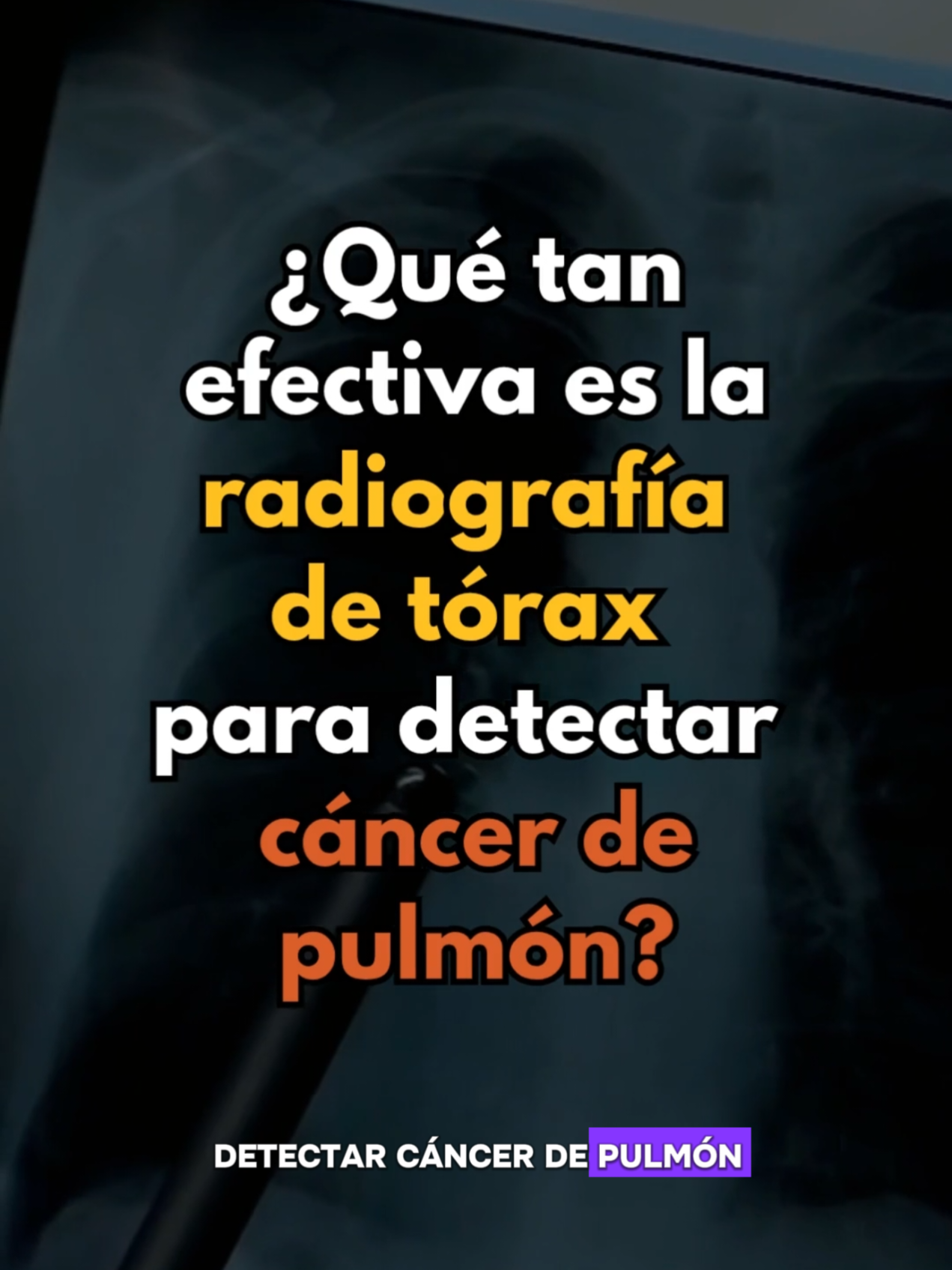 @Aula MEJOR