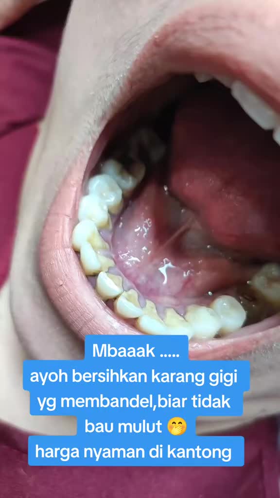 @mbak-Paijem