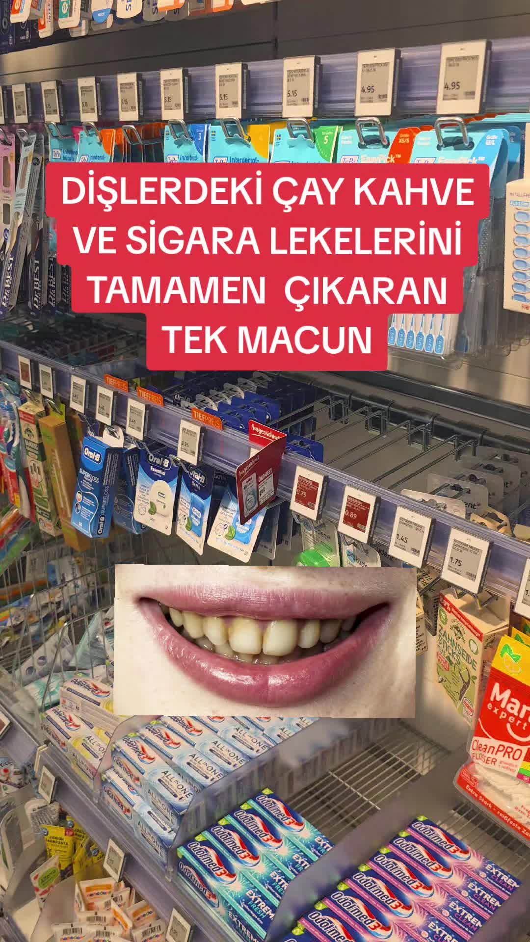 @Gurbetana27