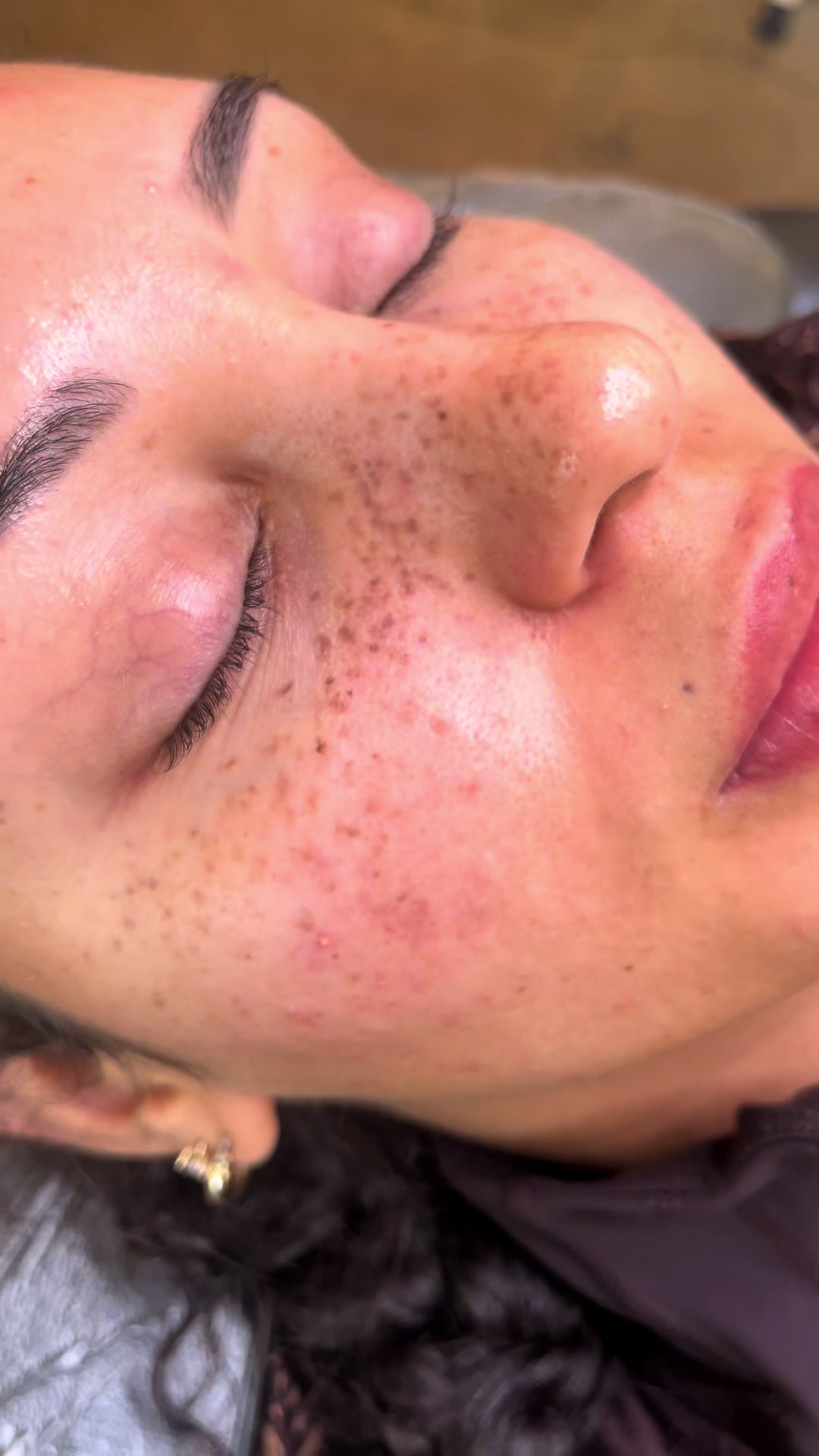 @Consuelo | Faux Freckles