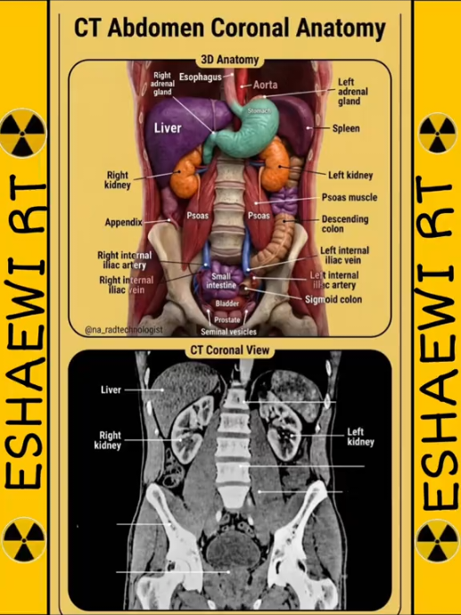 @☢️𝐄𝐒𝐇𝐀𝐄𝐖𝐈 𝐑𝐓☢️