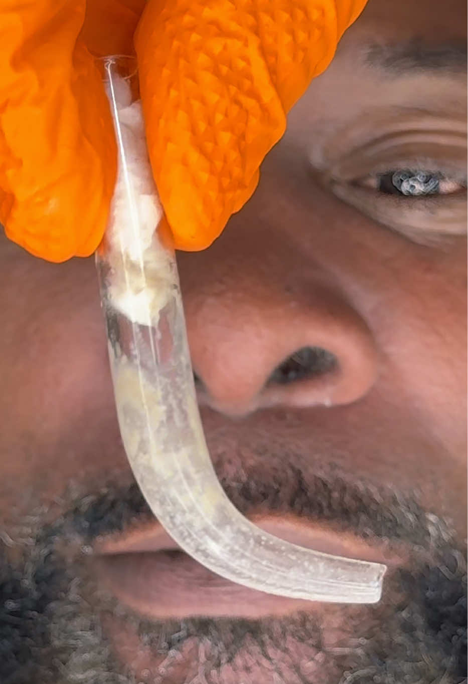 @Ronnie