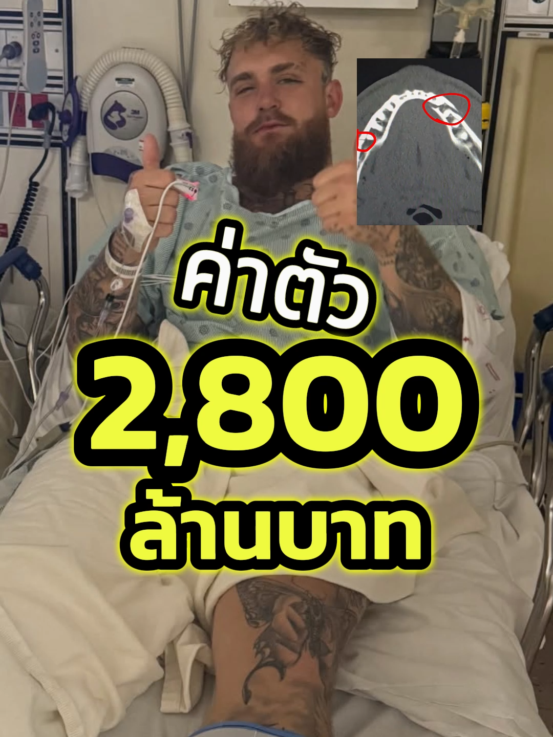 @Muay thai echo