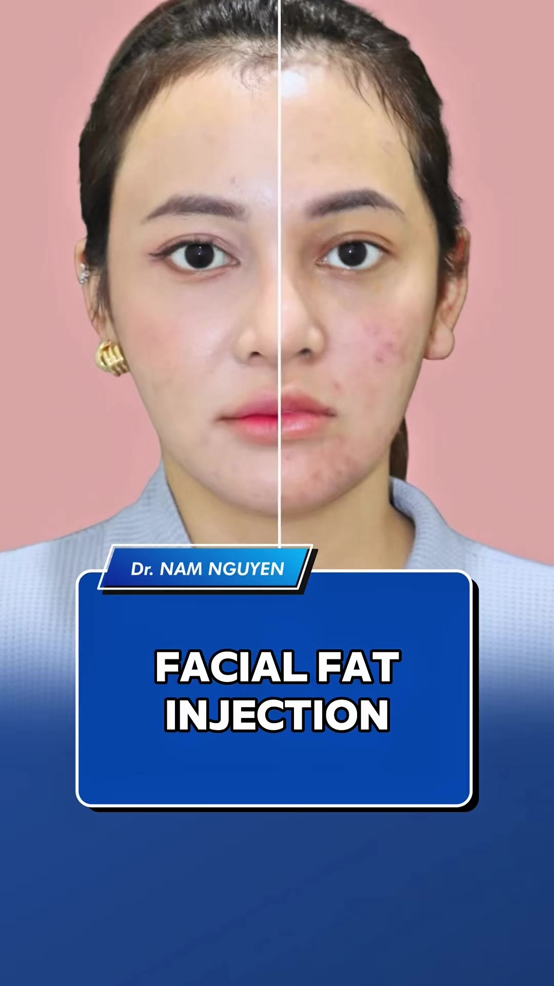 @Dr. Nam Nguyen