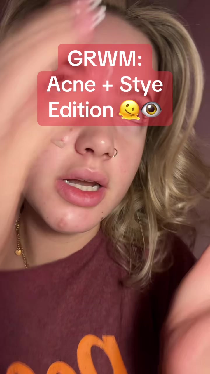 @cheeto🙈