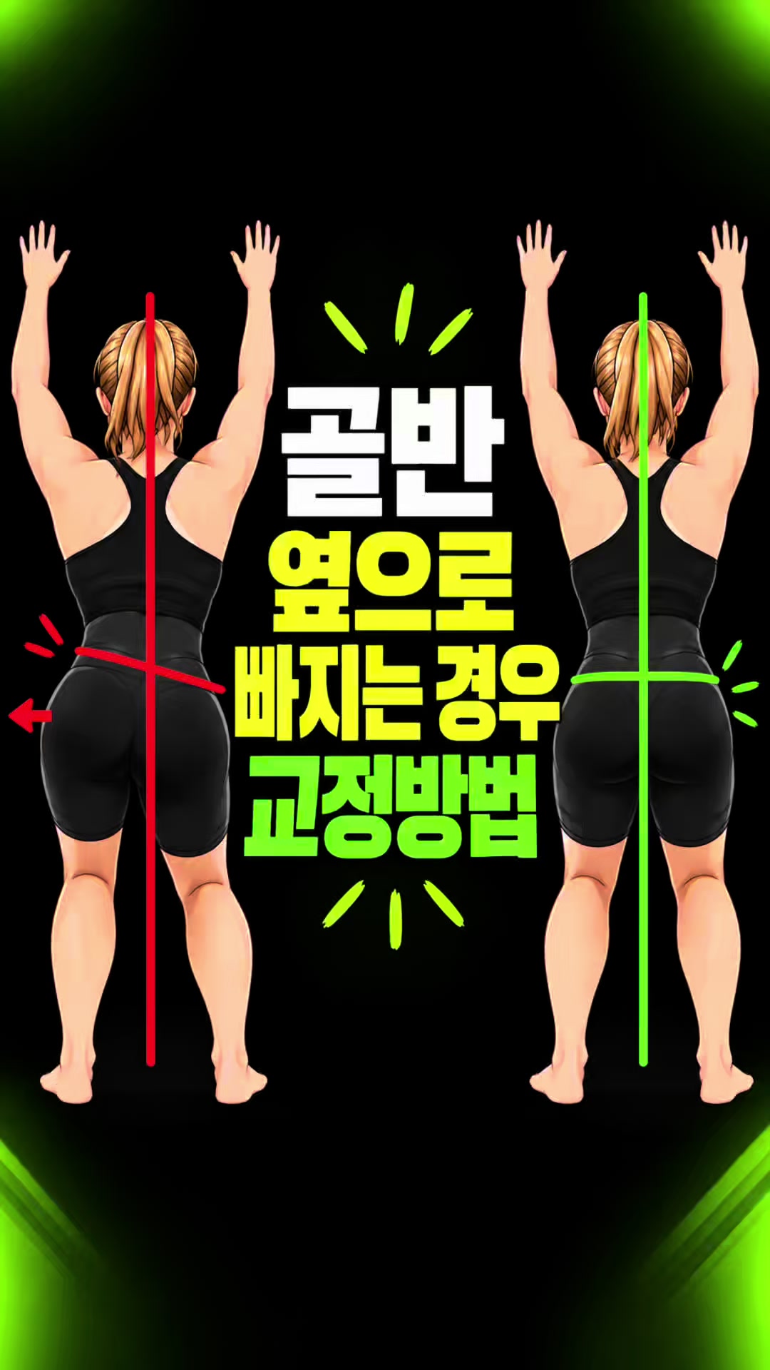 @재활운동촤이