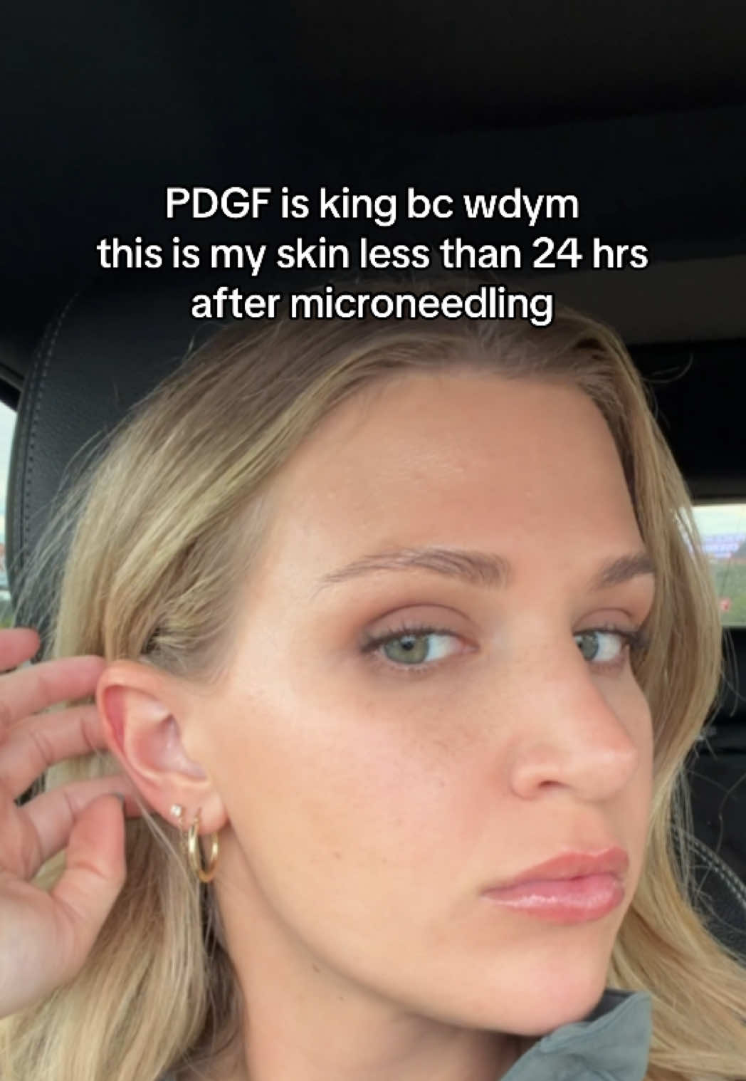 @Paige | ATL Injector