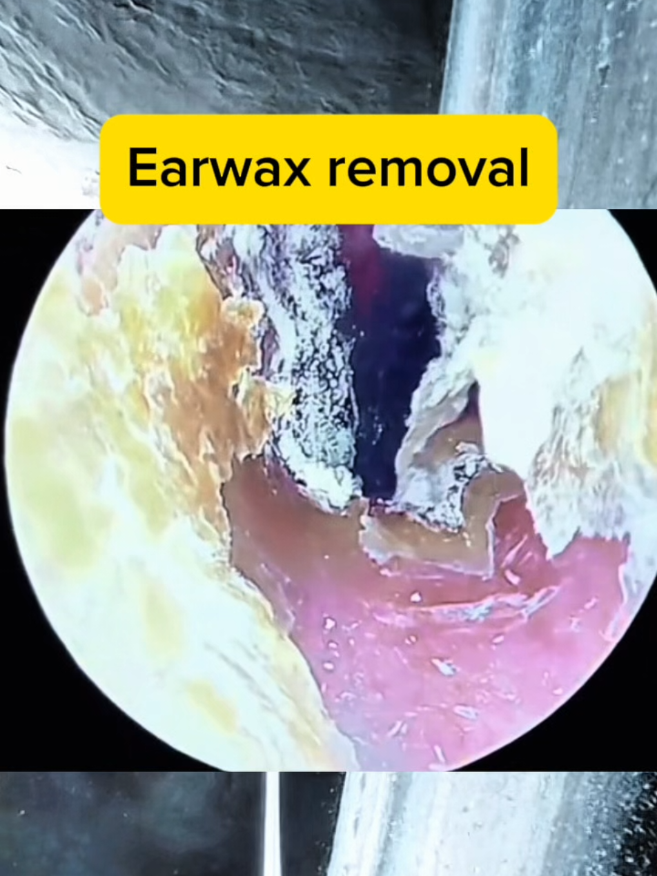 @Earwax.pro