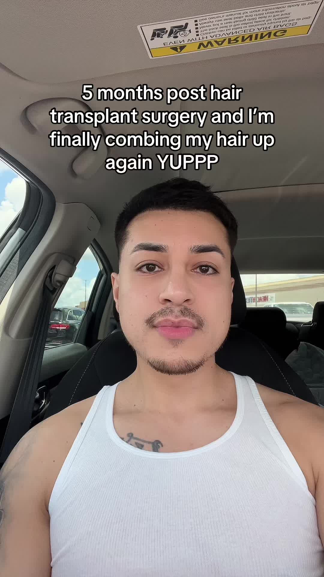 @Alexis