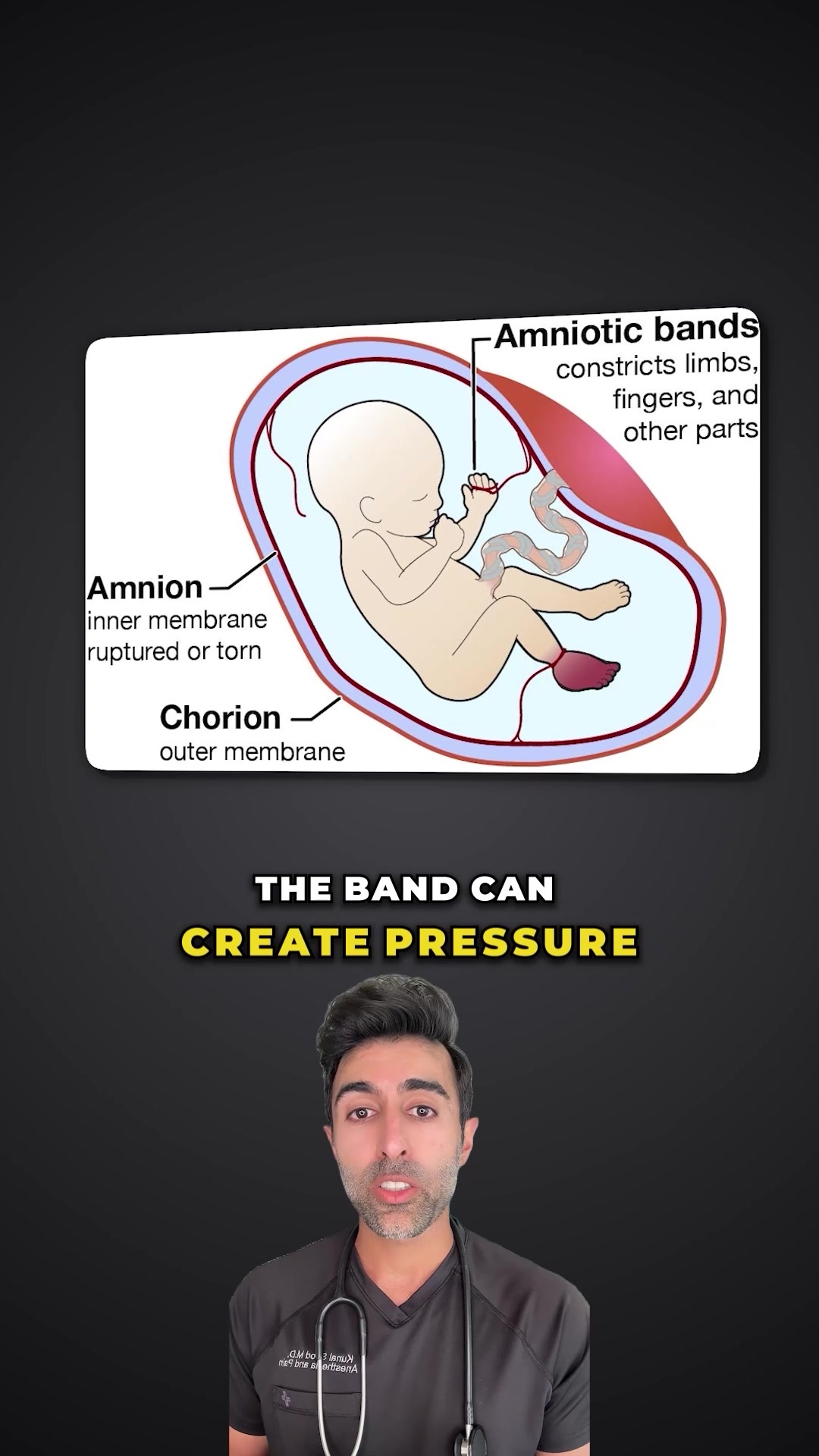 @DoctorSood, M.D.