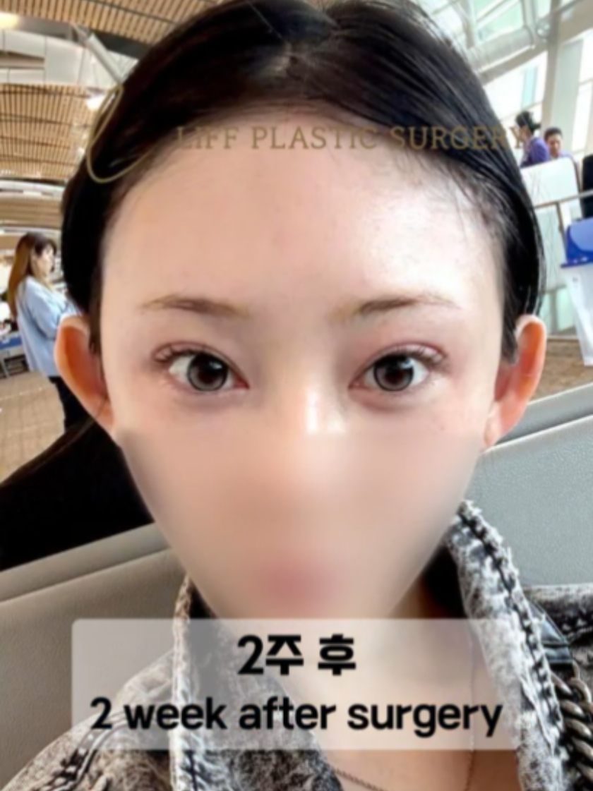 @리프성형외과 김기엽 대표원장