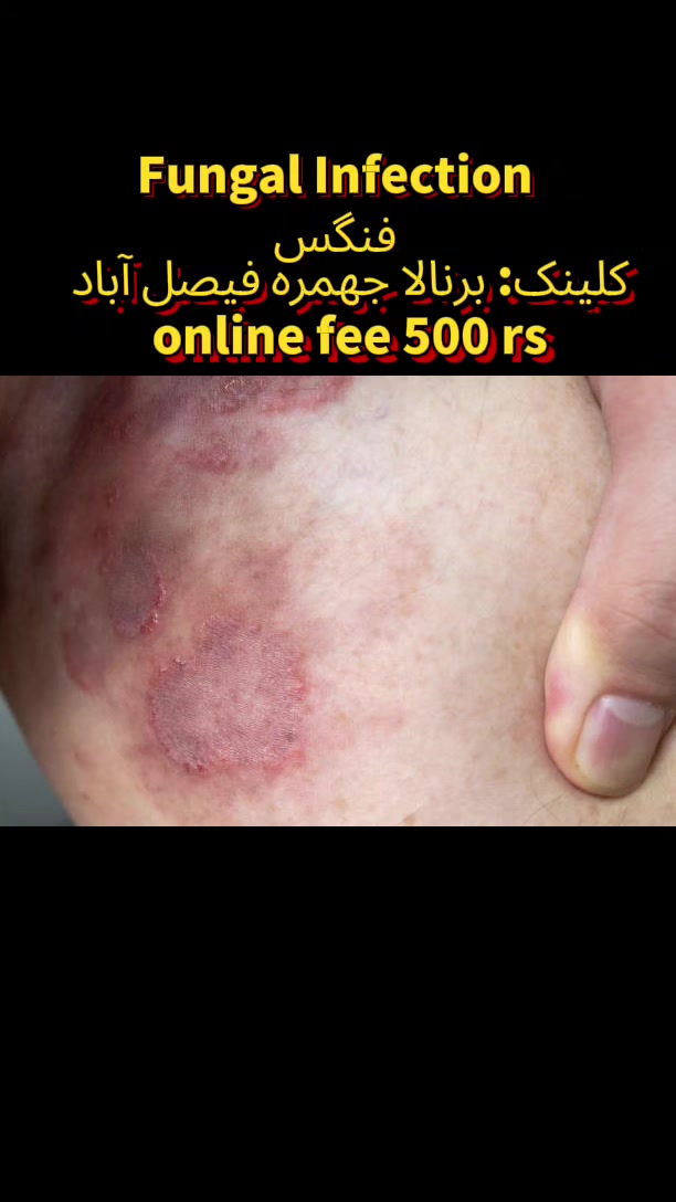 @MN HAIR AND SKIN CARE