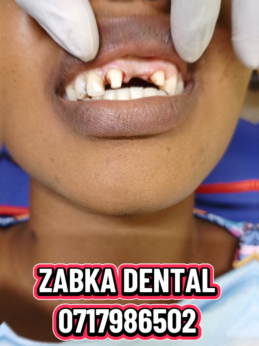 @Zabka Dental