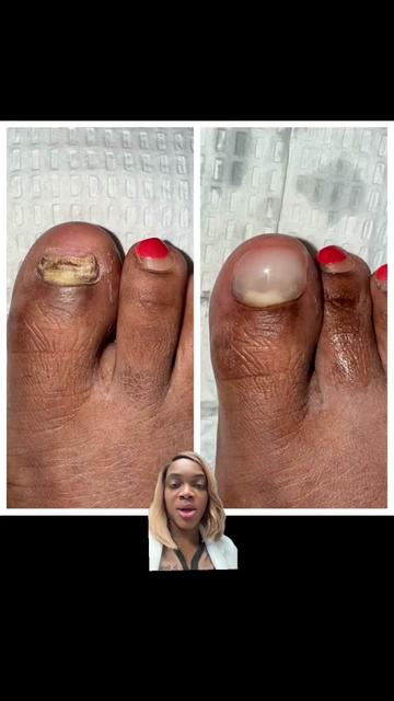 @Deniel Foot and Ankle Center