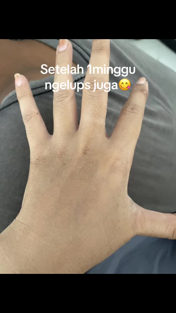 @Vithalstr