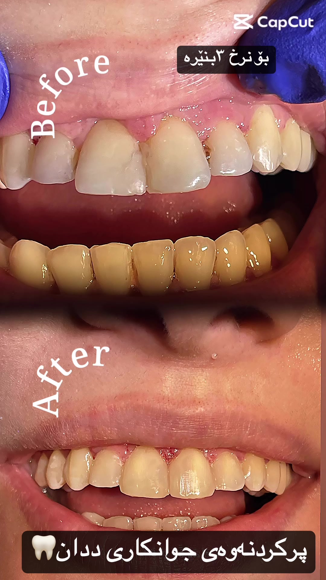 @🦷 دکتۆرە ئیمان کاکەمەم