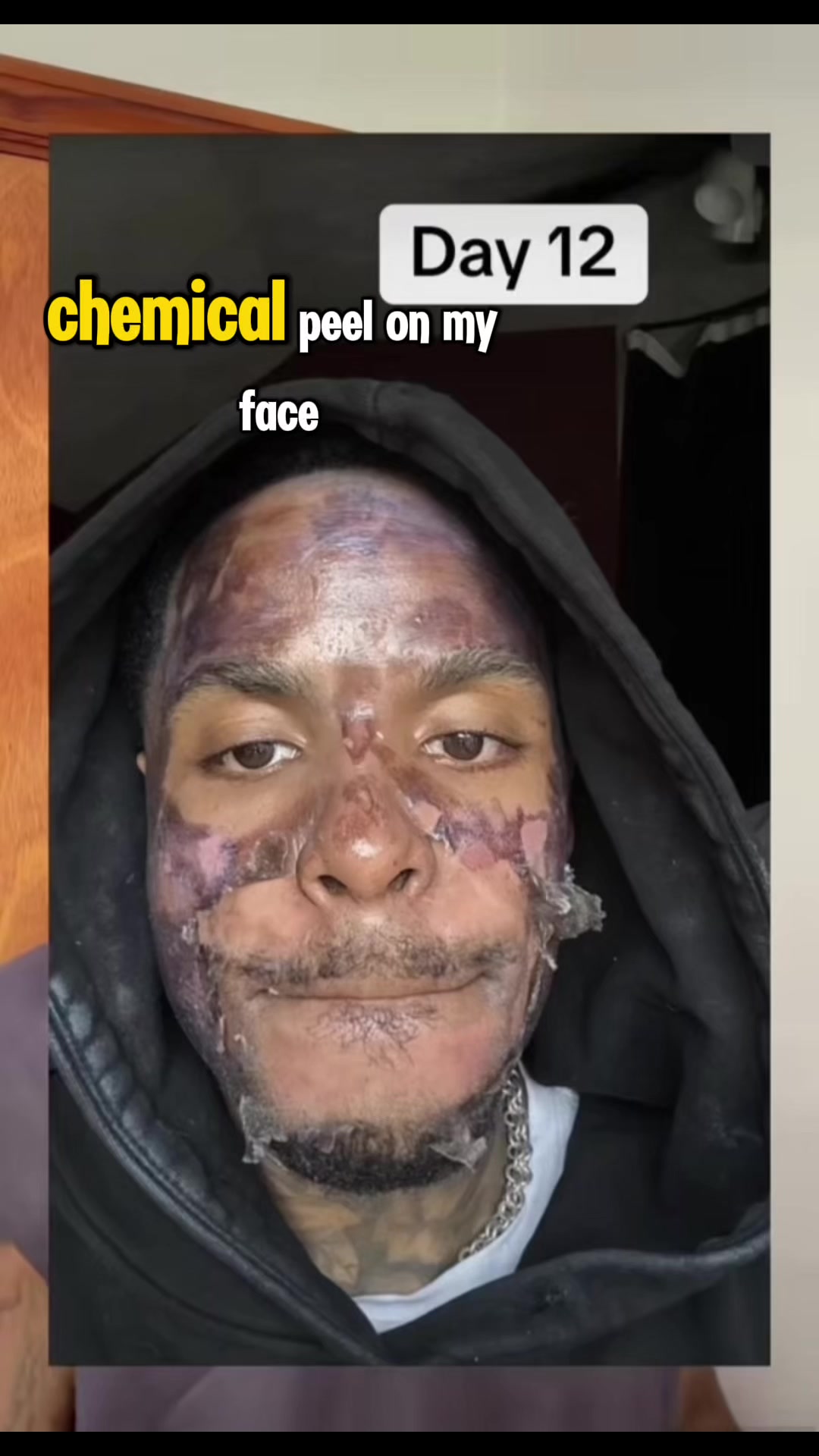 @Pure Skin OC