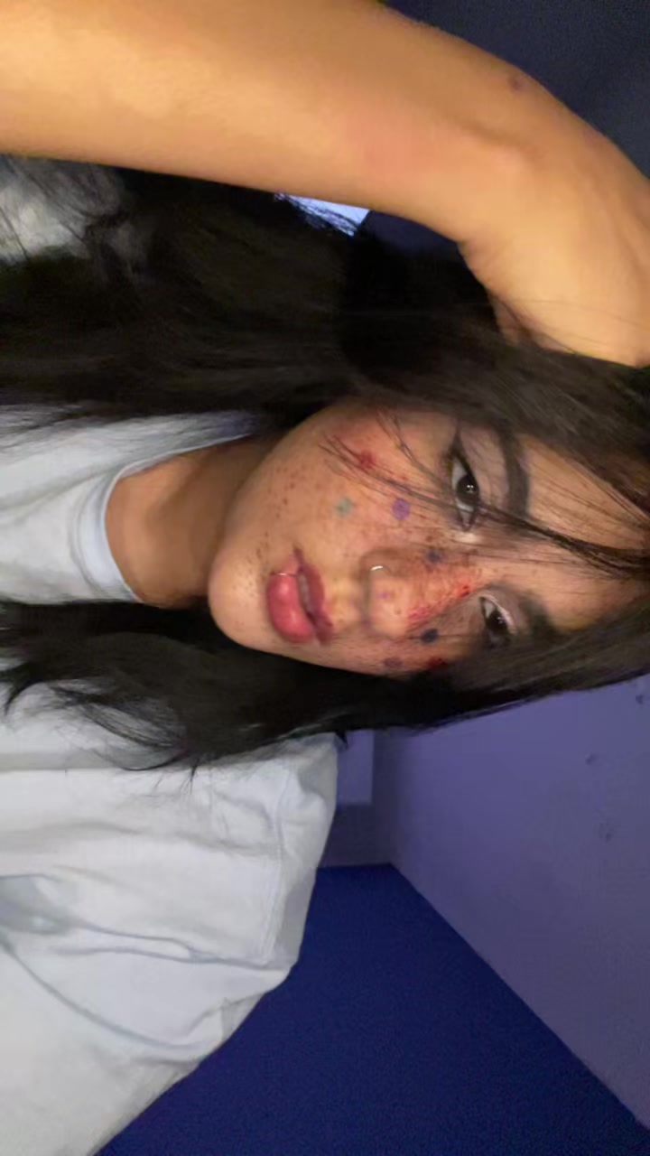 @๐๐๐๐๐๐๐ ๐ฆ