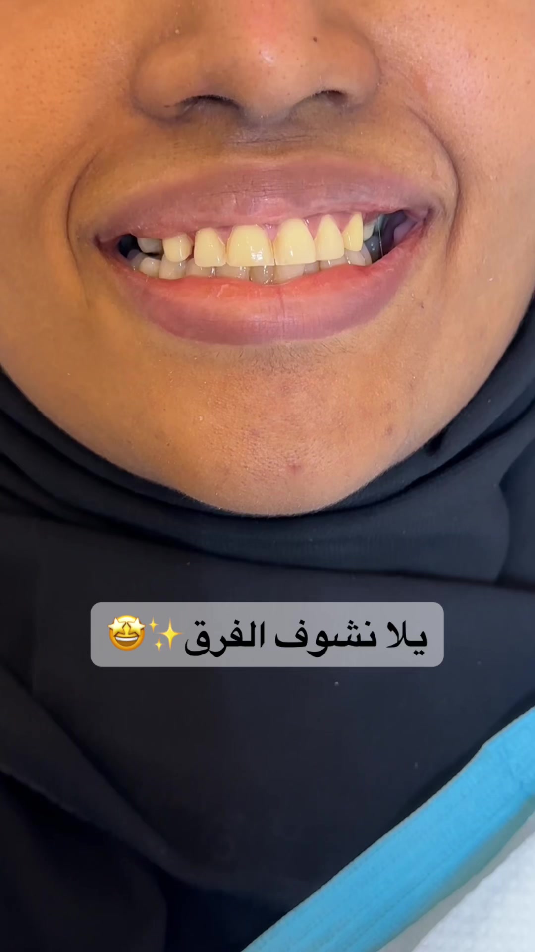@Dr.ranaalsilani