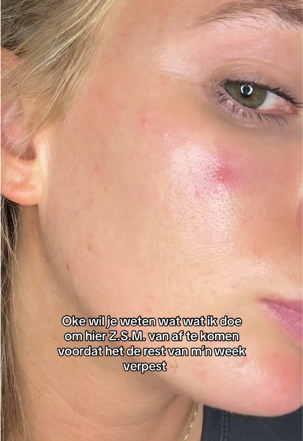 @Skinfixer