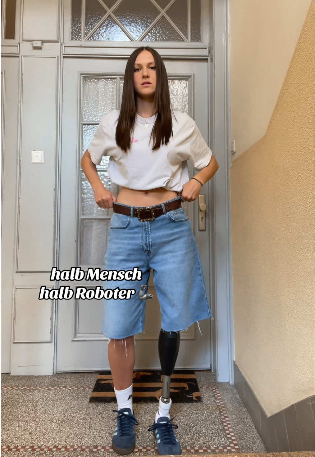 @NicolaOneLeg