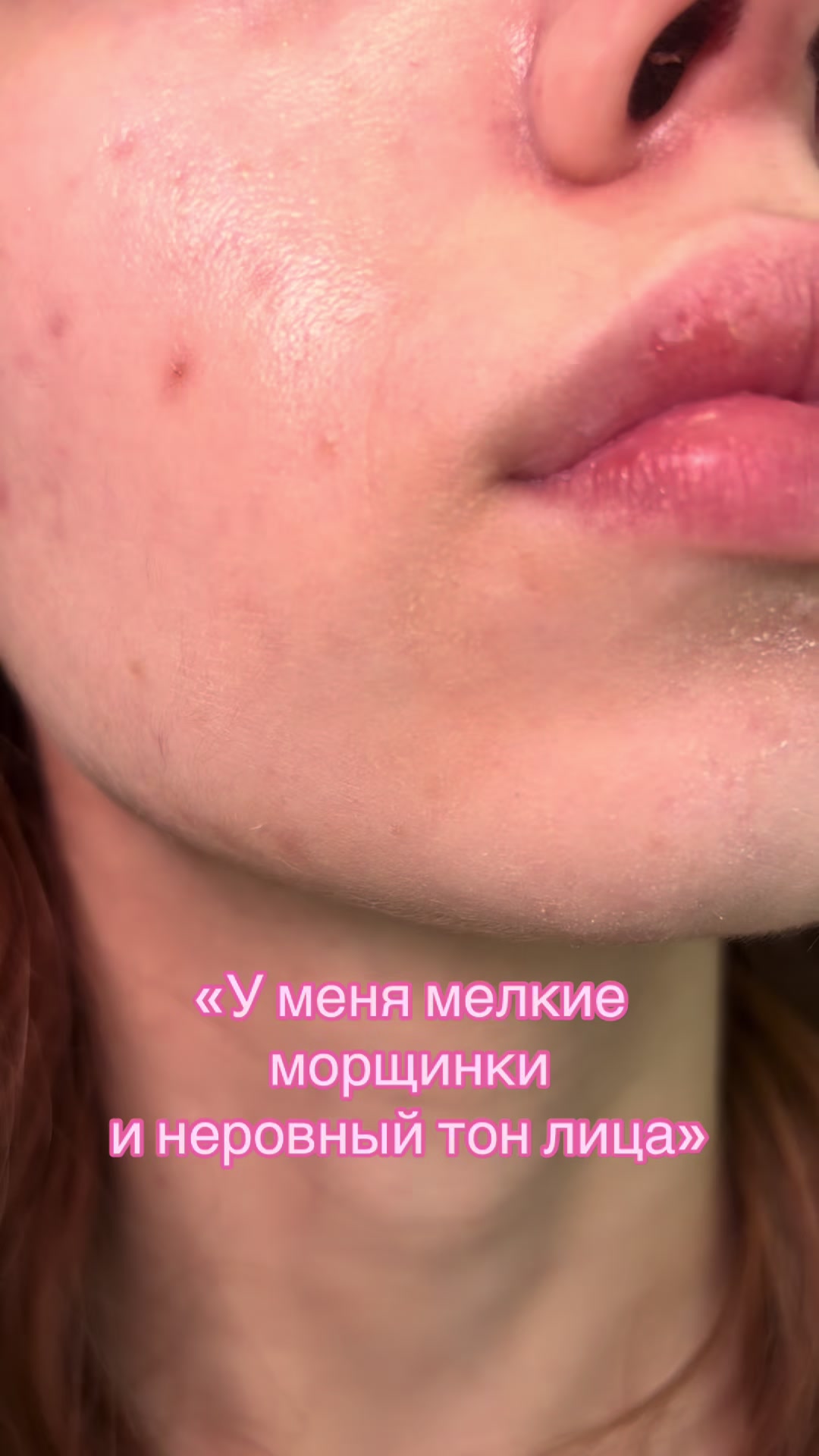 @аня anoharda