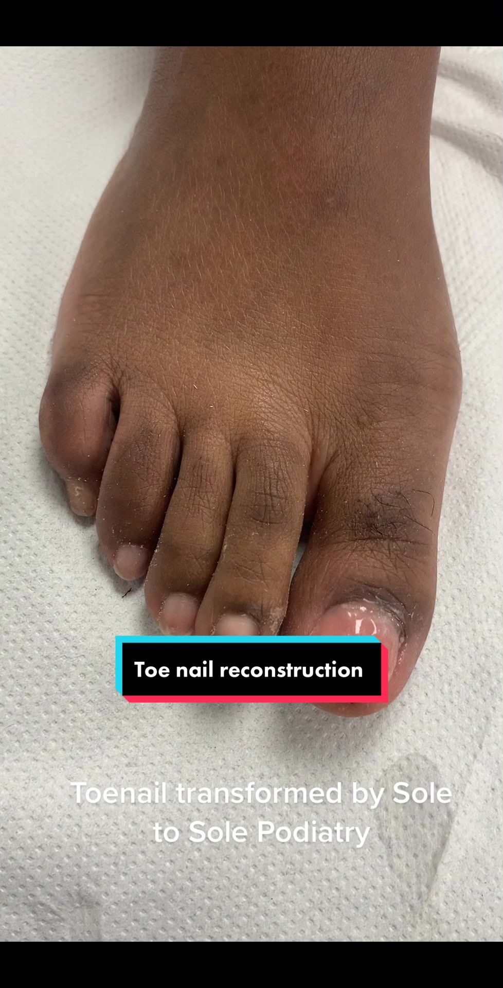 @Sole2Solepod