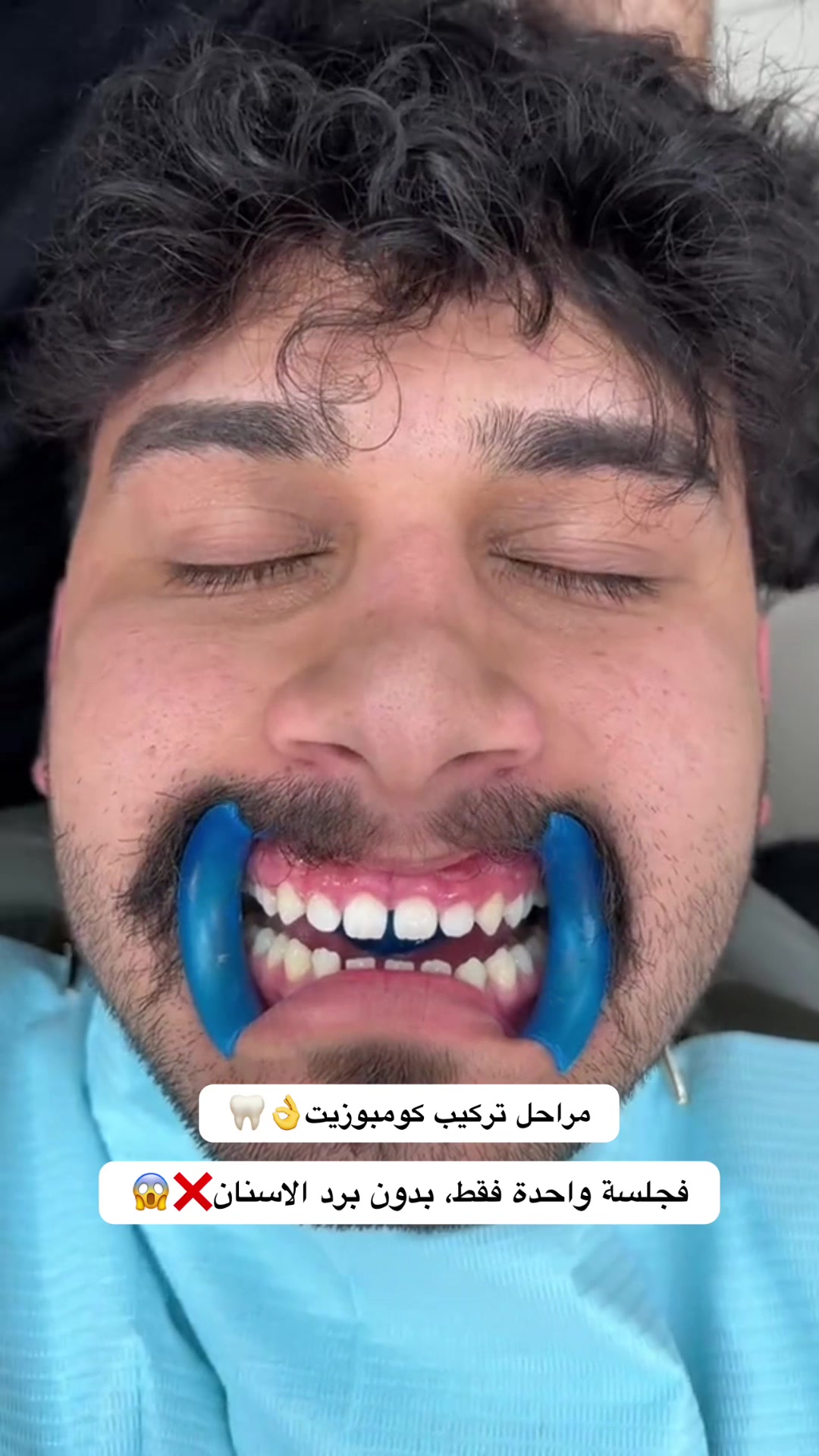 @brightsmileee1