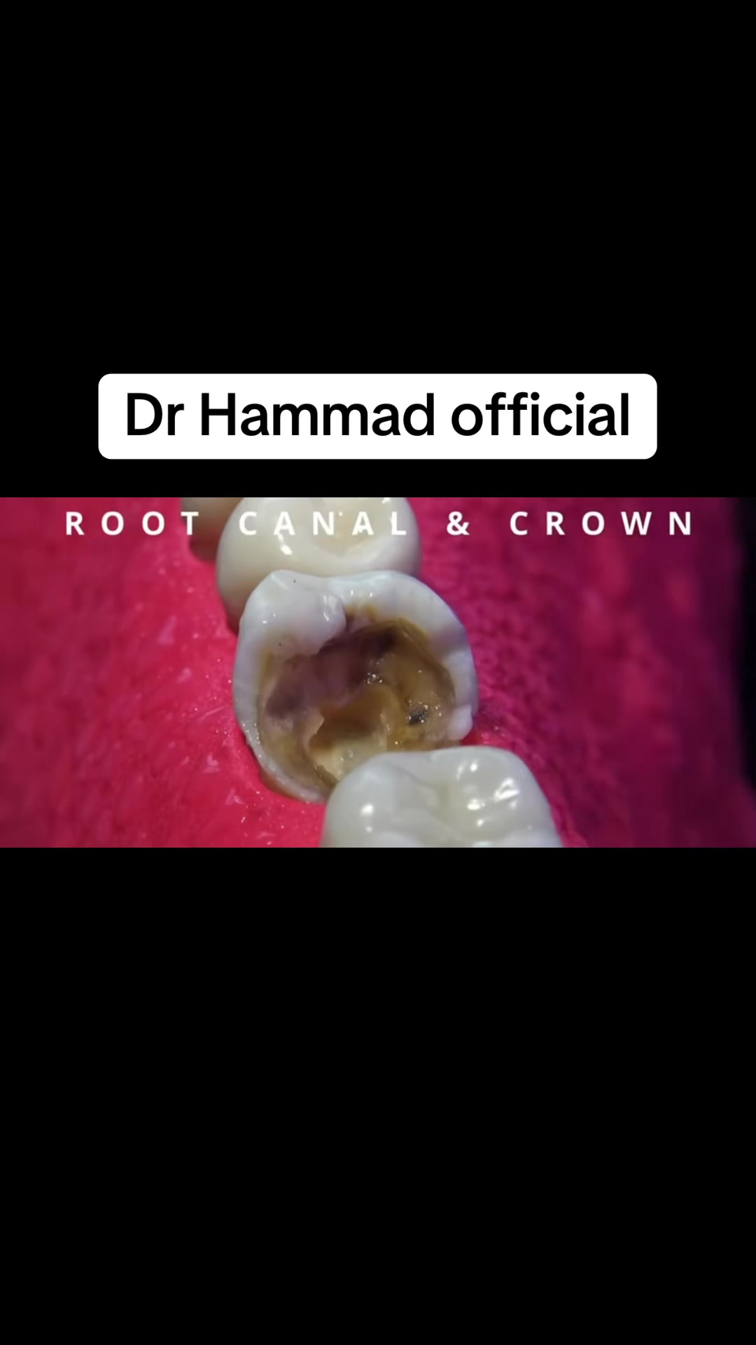@🥀Dr_Hammad_official🥀