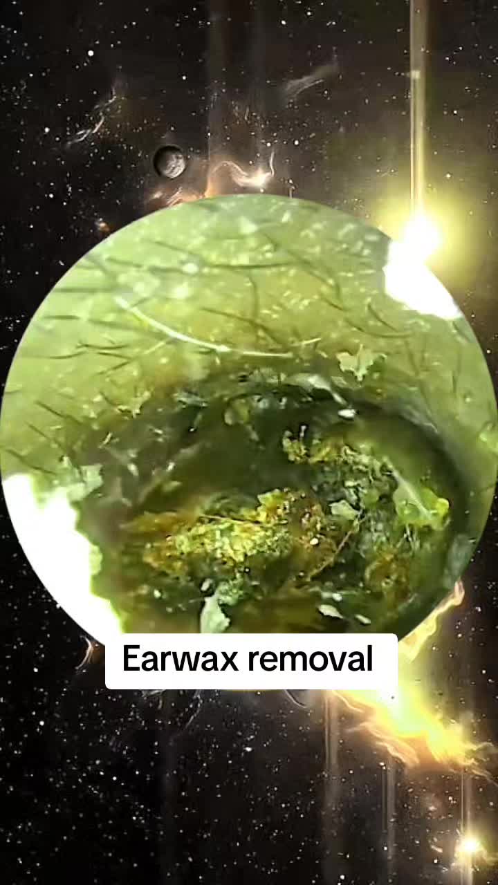 @Earwax.pro