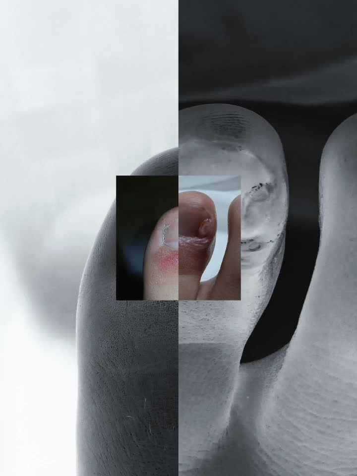 @에겐
