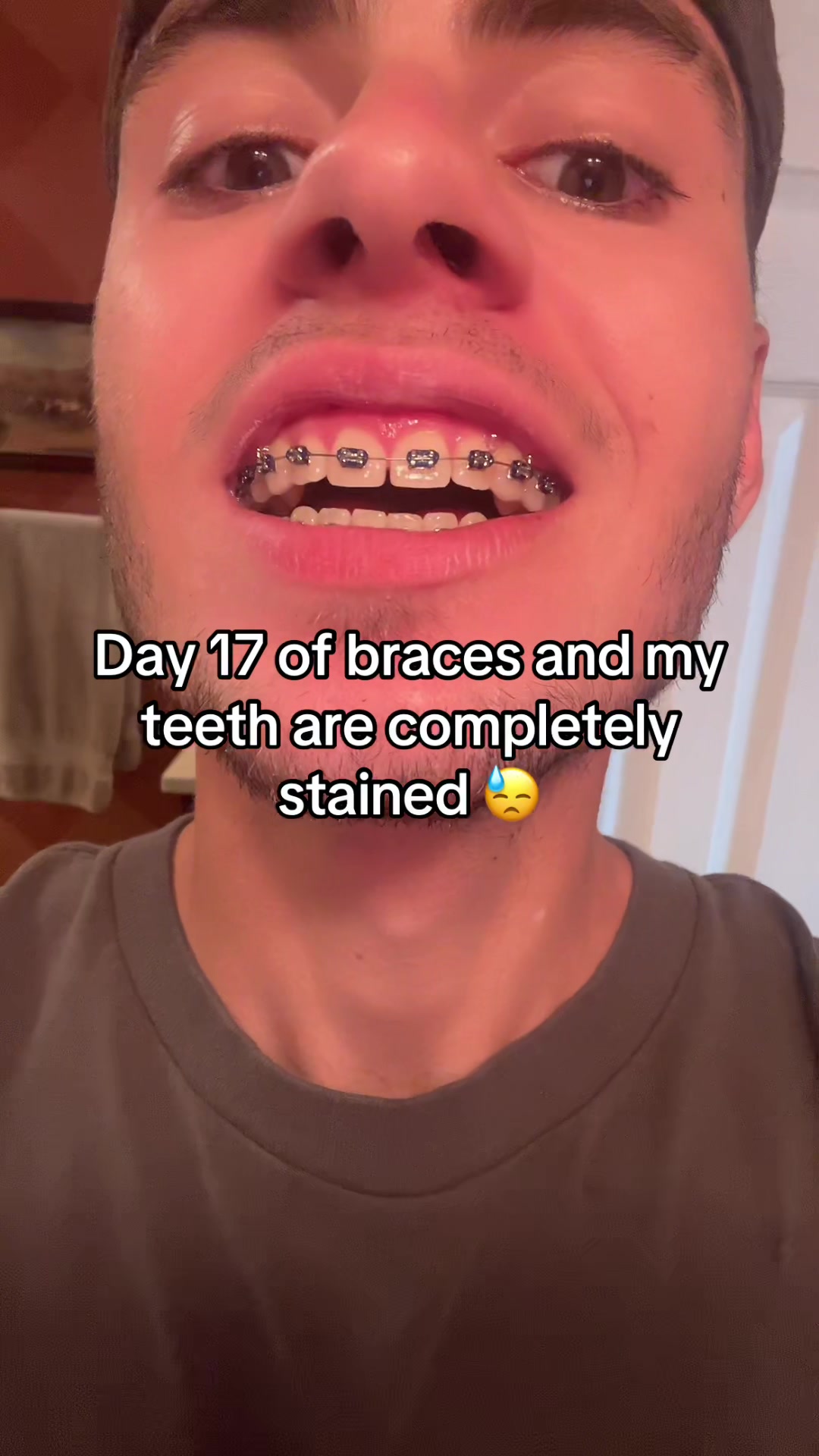 @mysmilejourney