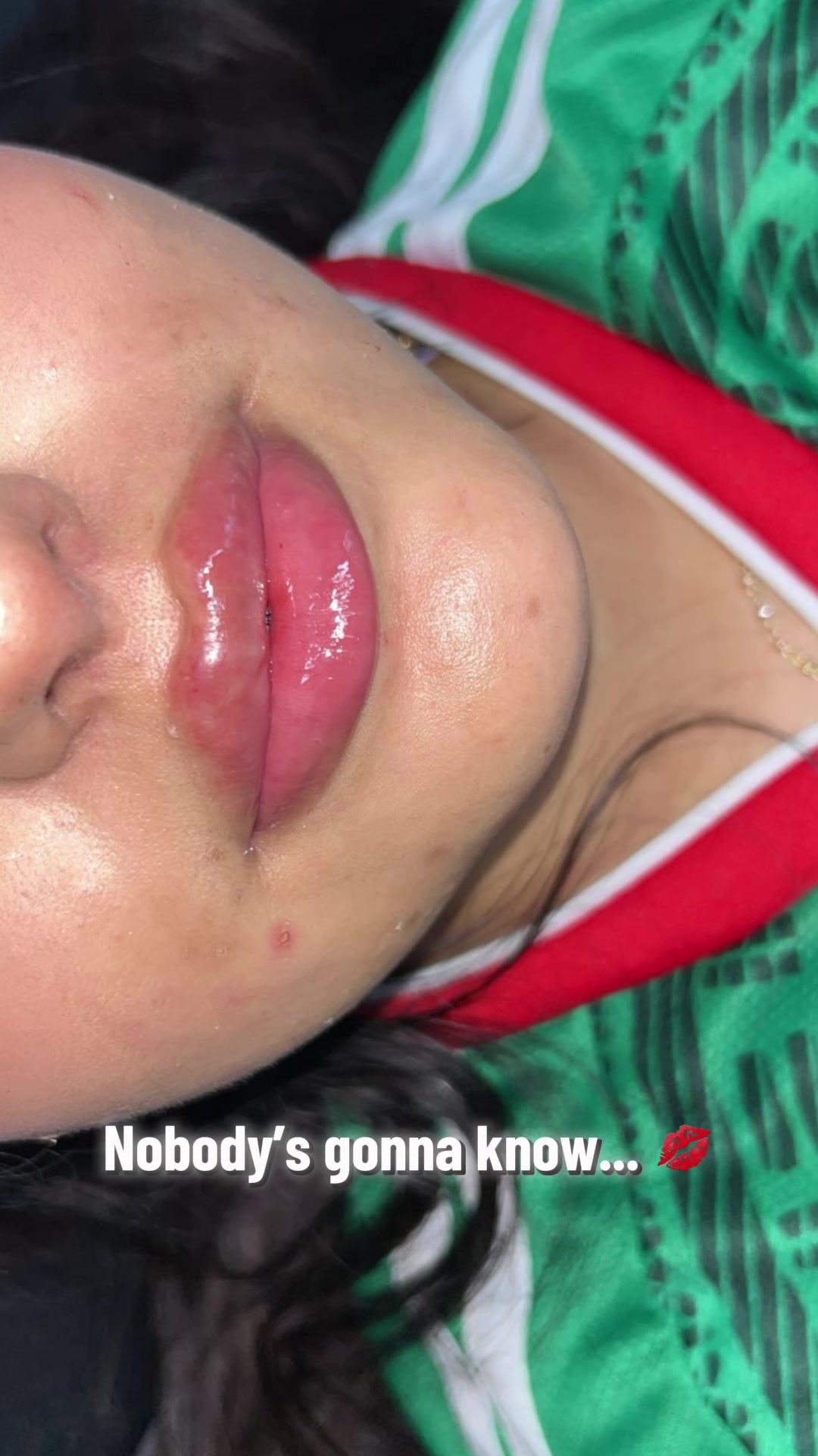 @injectormami