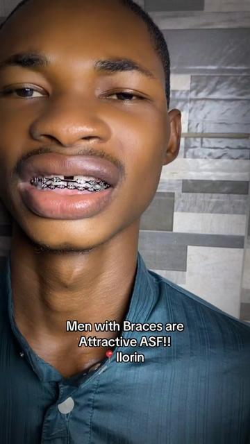@Braces.bymavi|Smile Aesthetics