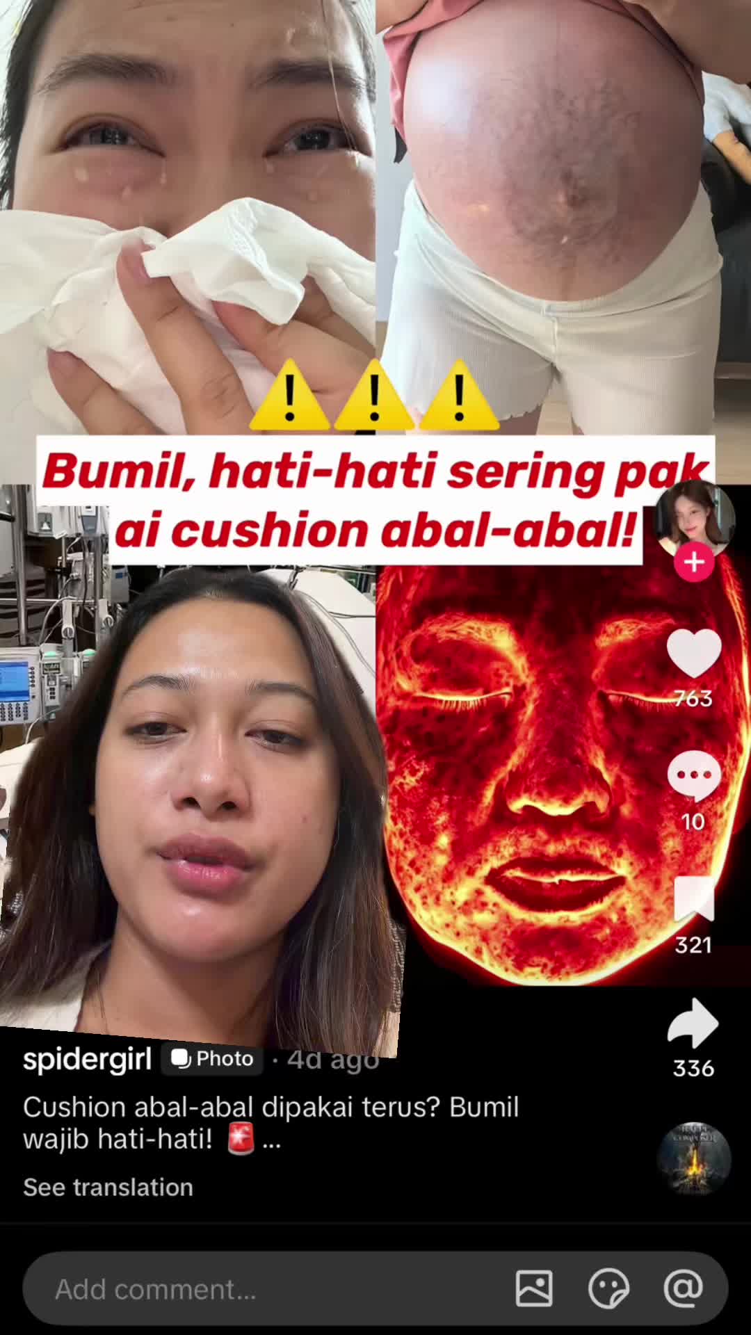 @Irnaayu27