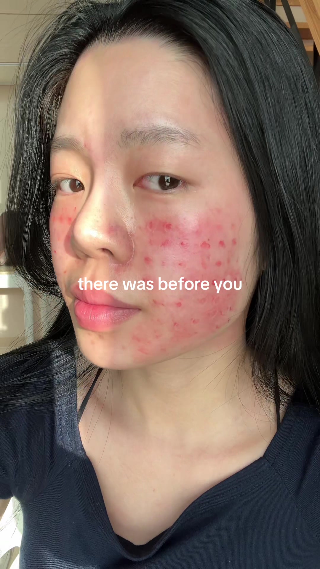 @Tracyskin