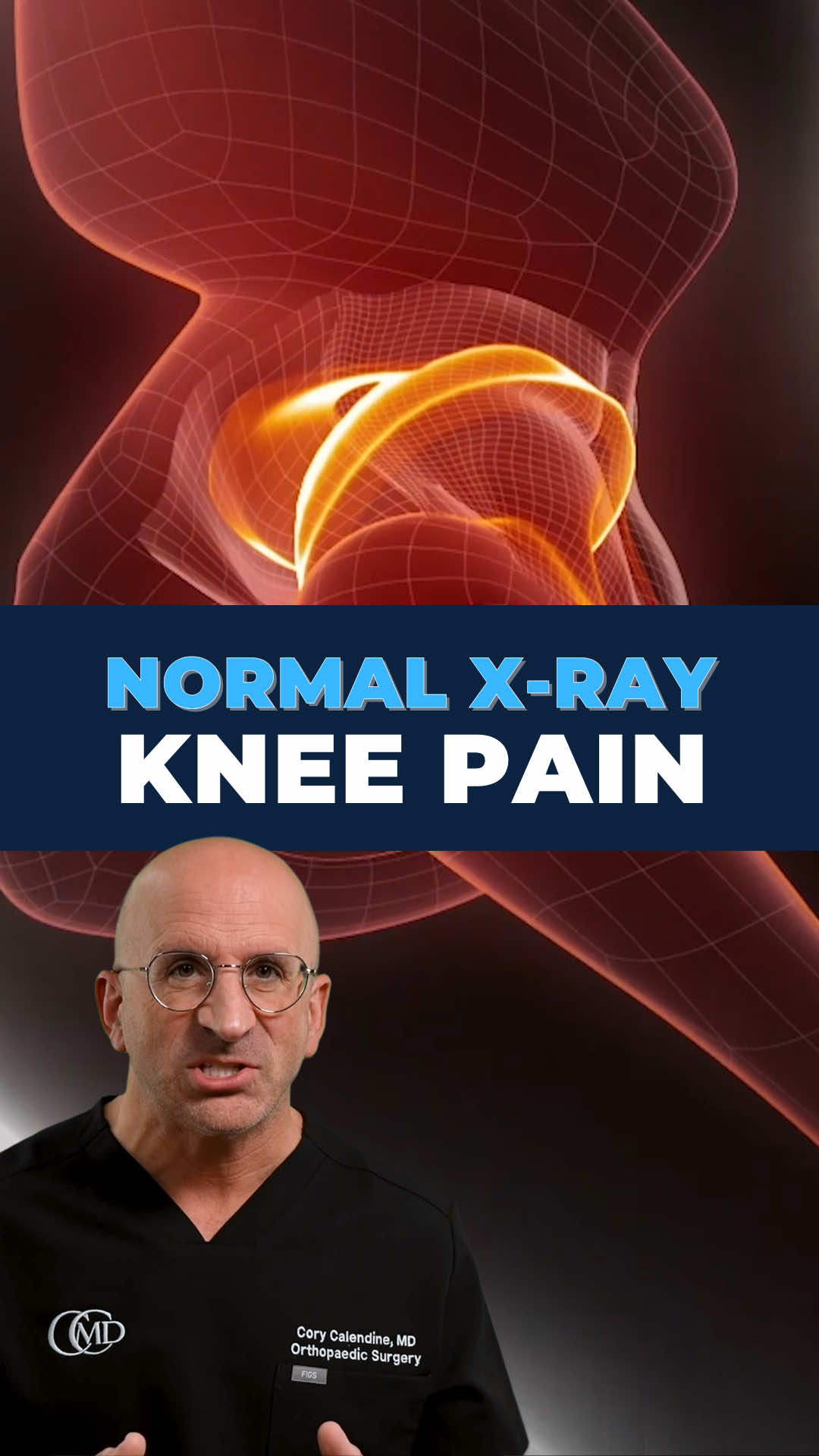 @Bone Doctor - Joint Pain MD