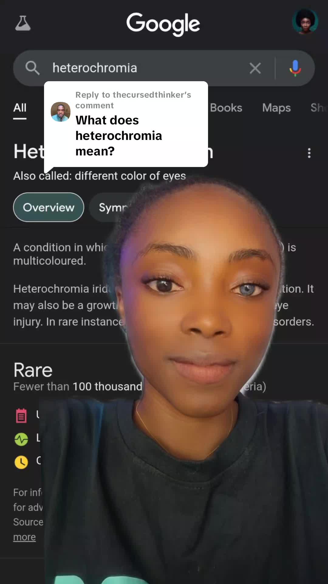 @Nana with Heterochromia