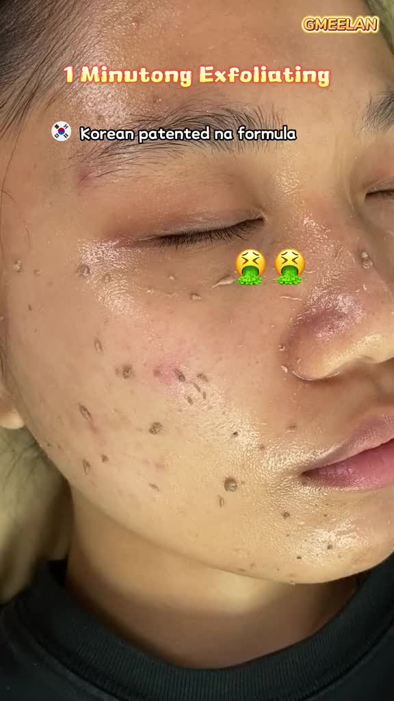 @irene